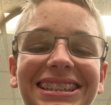 Son gets pink braces for dad . survivor. Phelps Memorial oncology